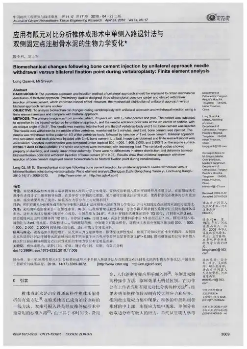 应用有限元对比分析椎体成形术中单侧入路退针法与双侧固定点注射骨水泥的生物力学变化
