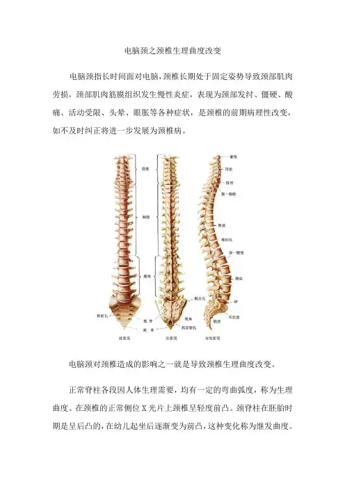 电脑颈之颈椎生理曲度改变