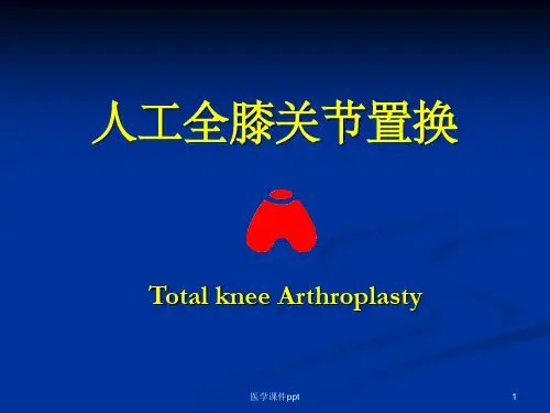 人工全膝关节置换髌骨问题