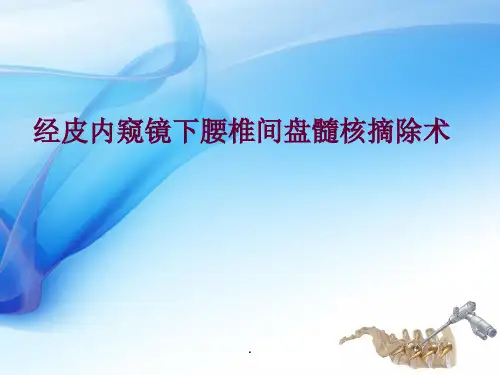 椎间孔镜手术技术ppt课件