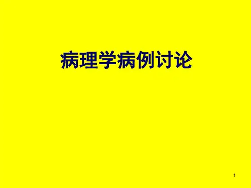 病理学病例讨论慢性肝炎肝硬化肝癌ppt课件
