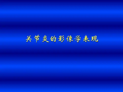 关节炎的影像学表现