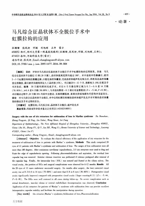 马凡综合征晶状体不全脱位手术中虹膜拉钩的应用解析