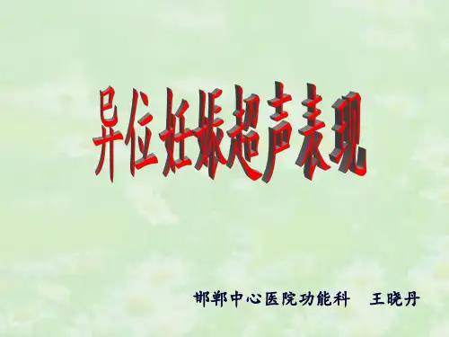异位妊娠超声表现