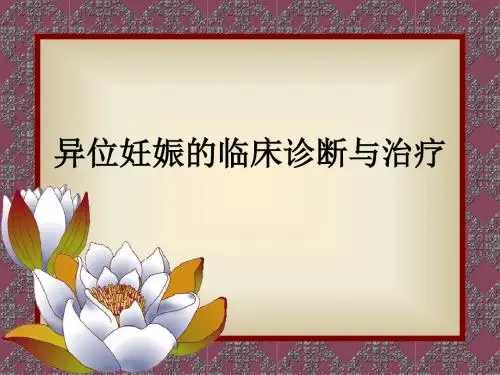 异位妊娠的临床诊断与治疗ppt课件