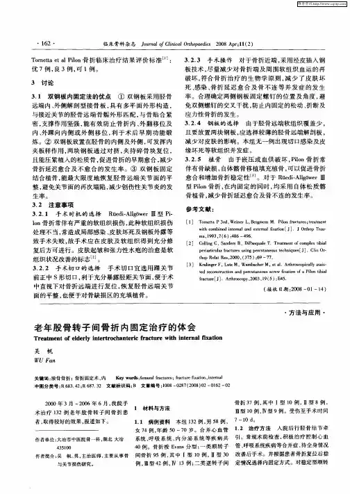 老年股骨转子间骨折内固定治疗的体会