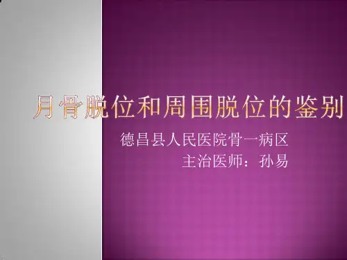 月骨脱位及周围脱位. - 副本