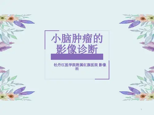 小脑肿瘤的影像诊断PPT课件