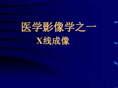 X线成像原理