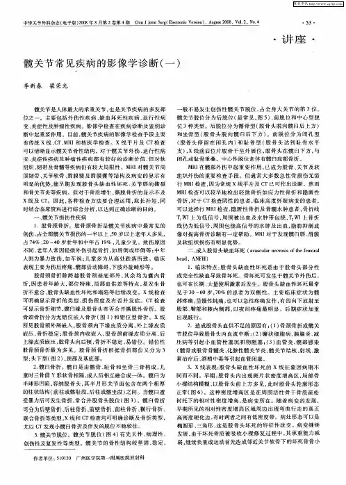 髋关节常见疾病的影像学诊断(一)