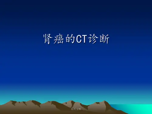 肾癌的CT诊断
