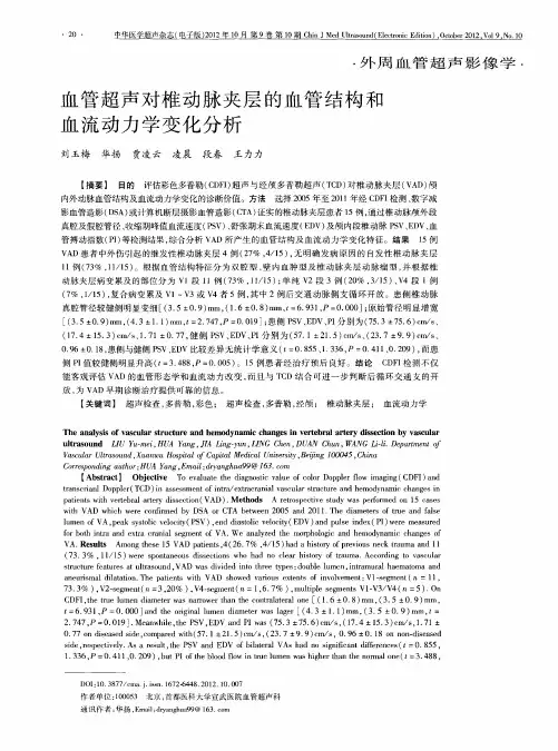 血管超声对椎动脉夹层的血管结构和血流动力学变化分析