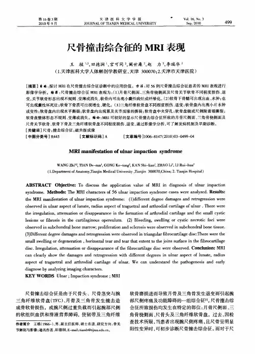 尺骨撞击综合征的MRI表现