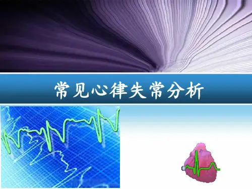 常见心律失常的分析