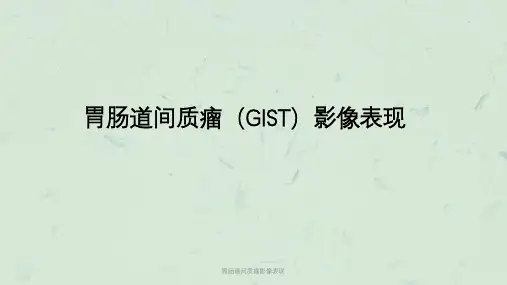 胃肠道间质瘤影像表现课件