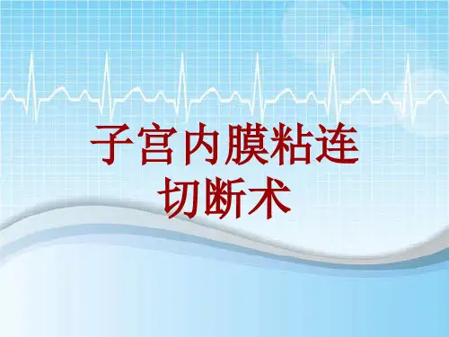 手术讲解模板:子宫内膜粘连切断术