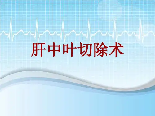 手术讲解模板:肝中叶切除术