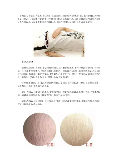 去掉妊娠纹必备小知识