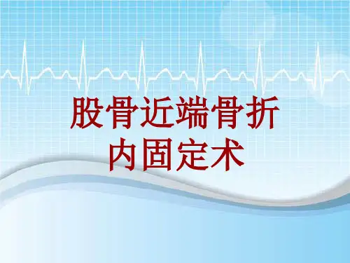 手术讲解模板：股骨近端骨折内固定术