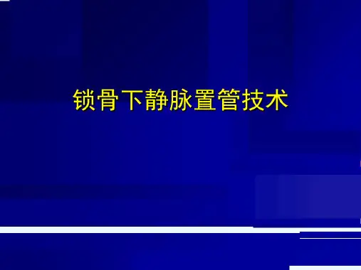 锁骨下静脉置管技术