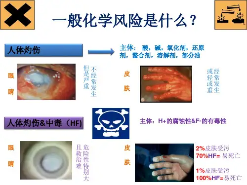 一般化学风险是什么?