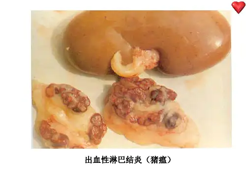出血性淋巴结炎