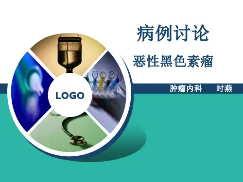 恶性黑色素瘤 2