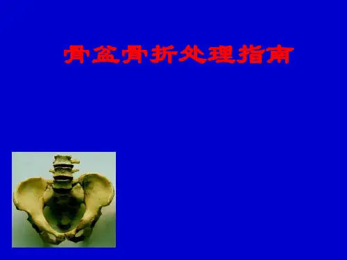 骨盆骨折处理指南