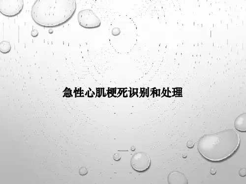 急性心肌梗死识别和处理PPT课件