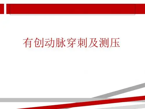 动脉穿刺