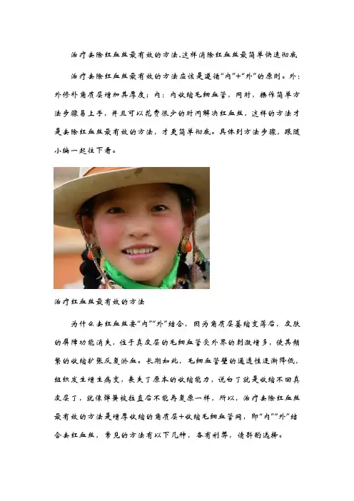 治疗去除红血丝最有效的方法,这样消除红血丝最简单快速彻底