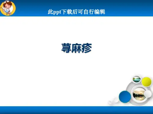 荨麻疹ppt课件