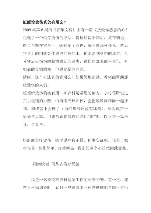 白糖蚯蚓治烫伤