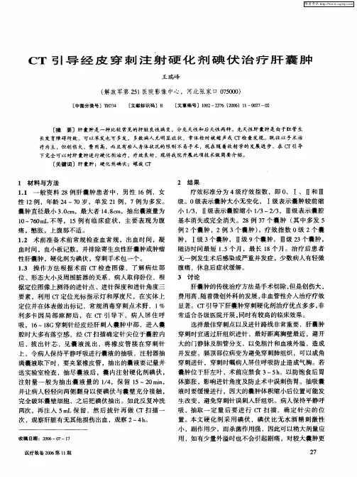 CT引导经皮穿刺注射硬化剂碘伏治疗肝囊肿