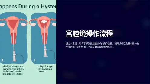 《宫腔镜操作流程》课件