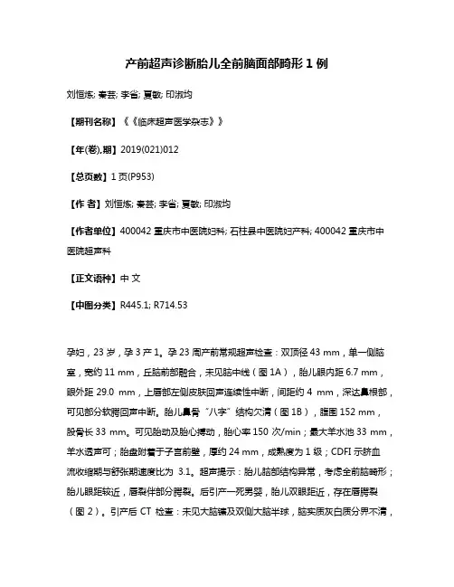 产前超声诊断胎儿全前脑面部畸形1例