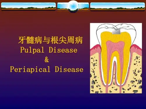 牙髓病与根尖周病