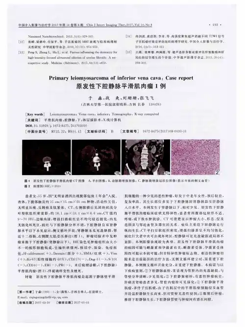 原发性下腔静脉平滑肌肉瘤1例