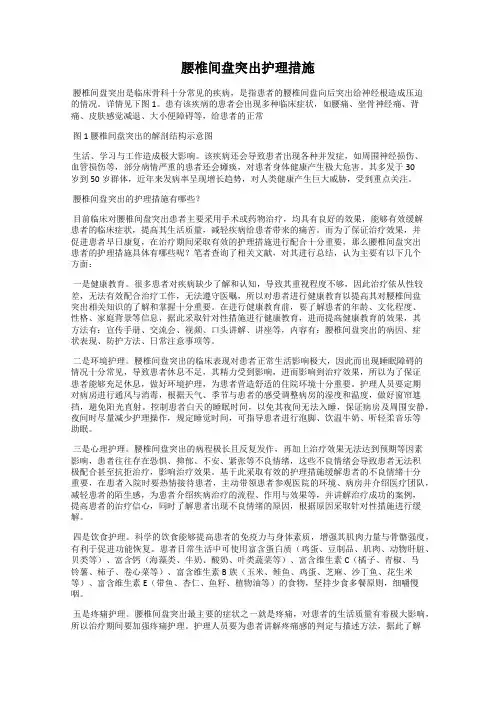 腰椎间盘突出护理措施