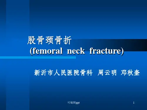 股骨颈骨折
