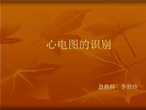 心电图的识别
