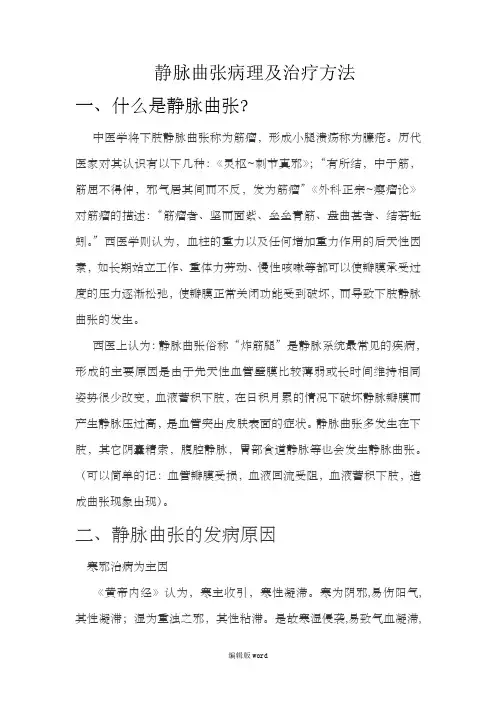 下肢静脉曲张