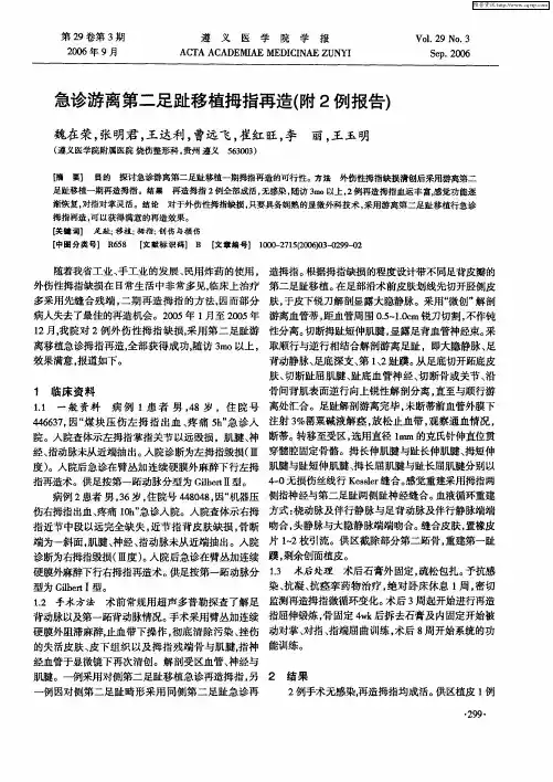 急诊游离第二足趾移植拇指再造(附2例报告)