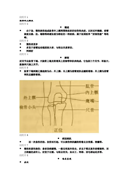 肱骨外上髁炎