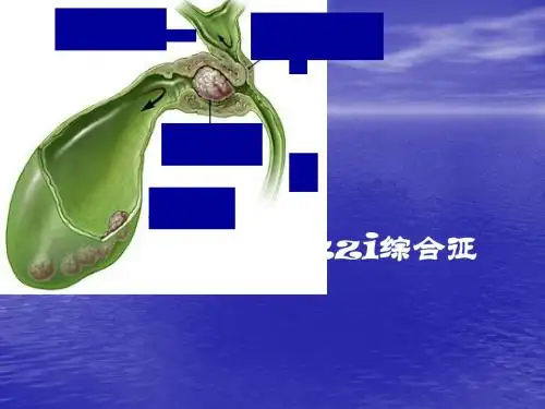 mirrizi综合征