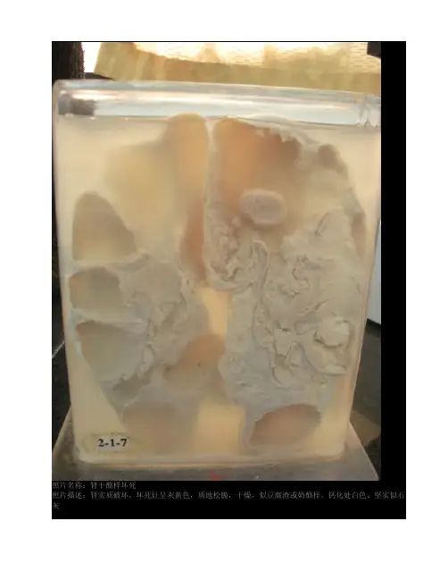 病理学实体 大体 标本
