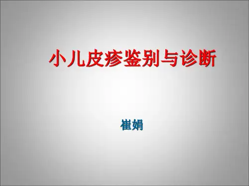 皮疹鉴别
