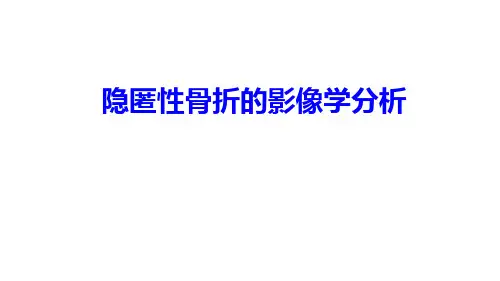 隐匿性骨折的影像学分析