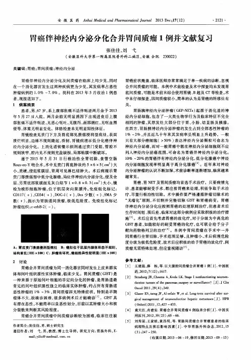 胃癌伴神经内分泌分化合并胃间质瘤1例并文献复习
