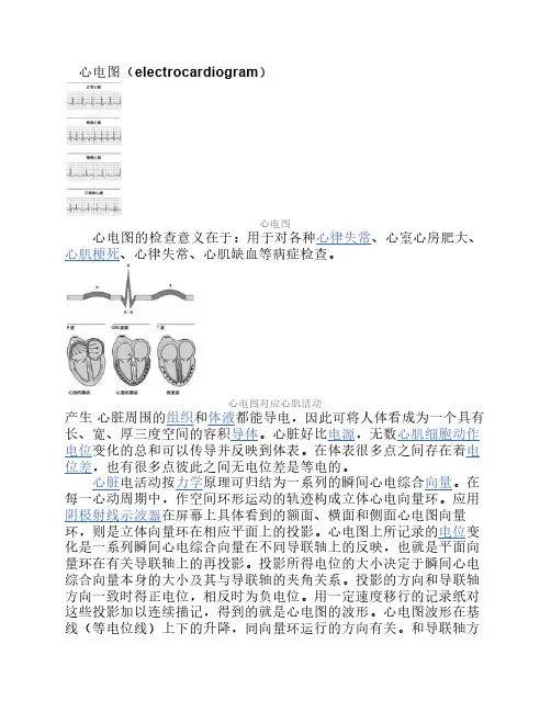 心电图 2